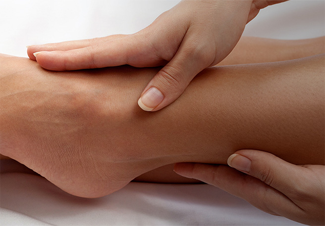 Las varices: Causas y consejos