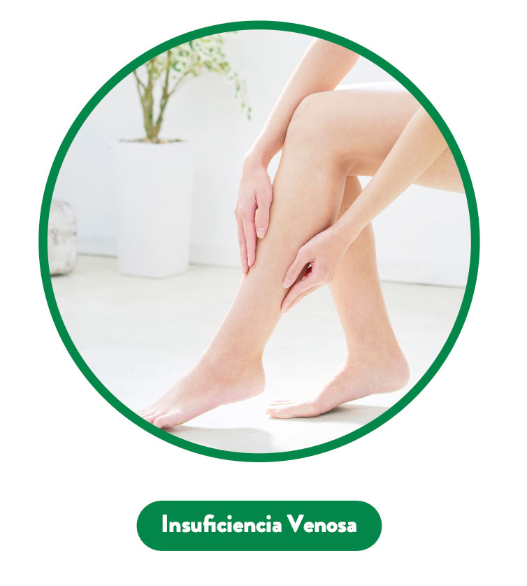 Insuficiencia venosa