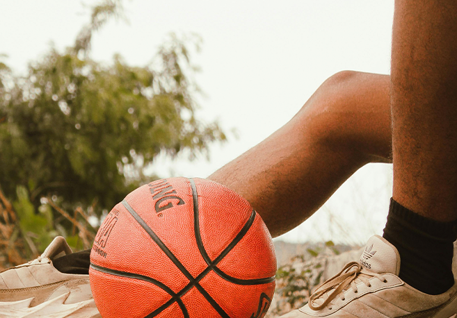 Cinco claves para aliviar las varices en primavera